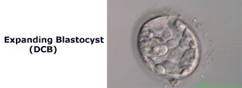 Image of Expanding Blastocyst (DCB)