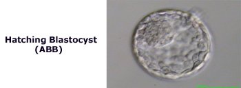 Image of  Hatching Blastocyst (ABB)