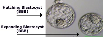 Image of Hatching Blastocyst and Expanding Blastocyst