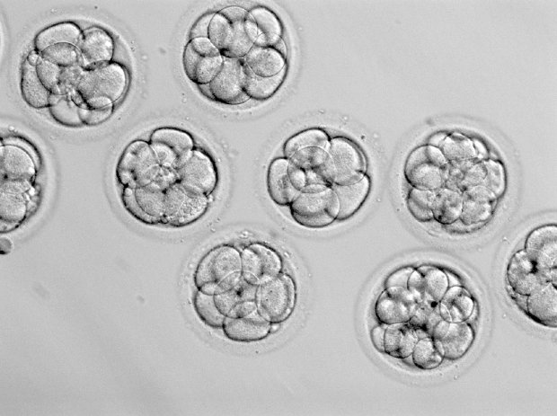 Embryos being considered for embryo grading