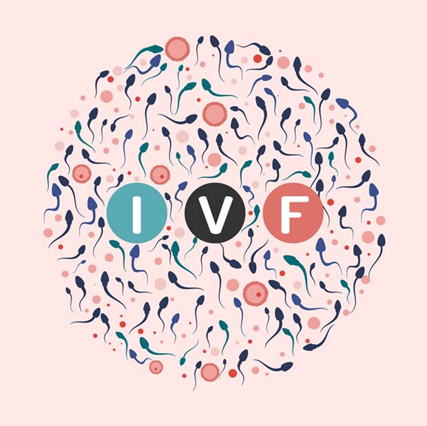 IVF Graphic