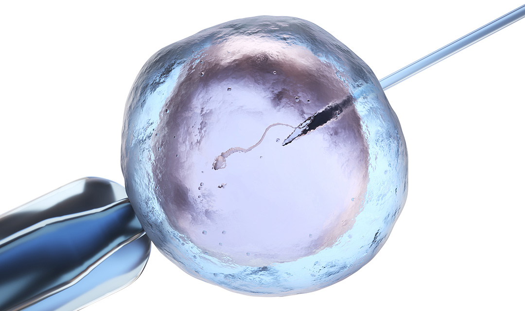 World IVF Day