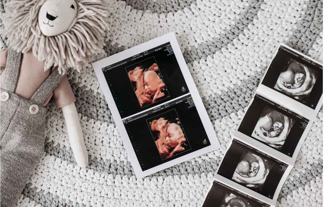 ultrasounds